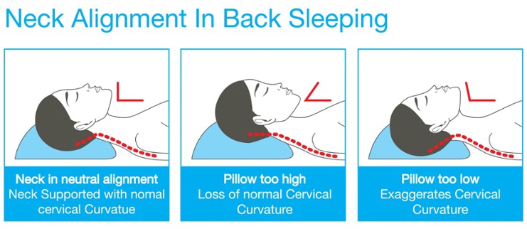 Neck Alignment in Back Sleeping