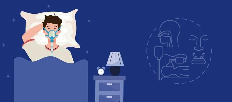 Obstructive Sleep Apnea